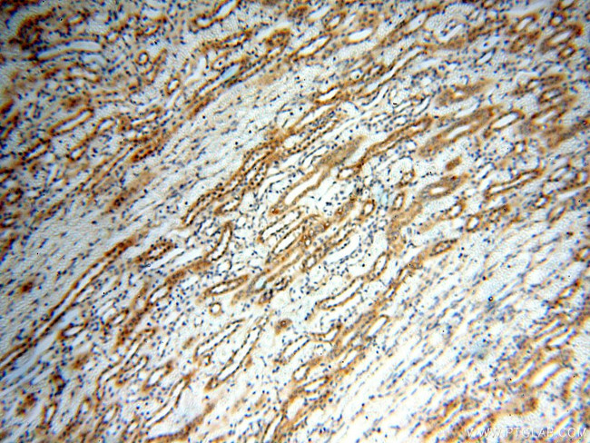 ACBD3 Antibody in Immunohistochemistry (Paraffin) (IHC (P))