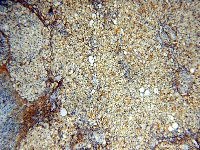 ACBD3 Antibody in Immunohistochemistry (Paraffin) (IHC (P))