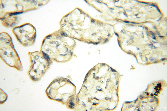 ACBD3 Antibody in Immunohistochemistry (Paraffin) (IHC (P))