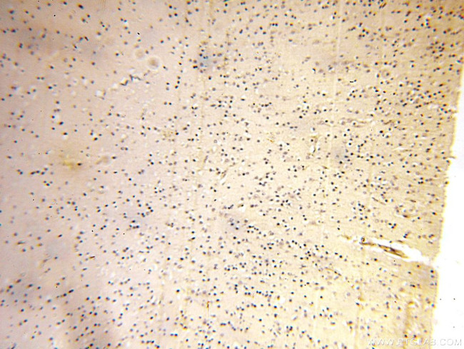 ACBD3 Antibody in Immunohistochemistry (Paraffin) (IHC (P))