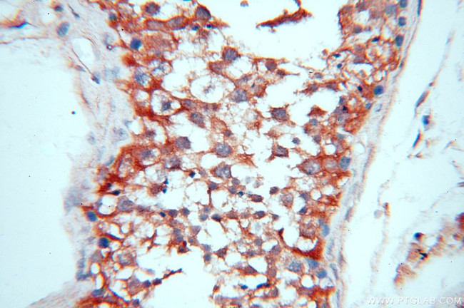 ACBD3 Antibody in Immunohistochemistry (Paraffin) (IHC (P))