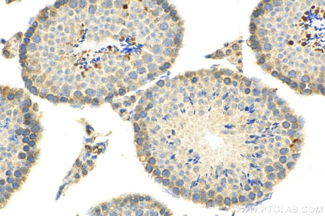 ACBD3 Antibody in Immunohistochemistry (Paraffin) (IHC (P))