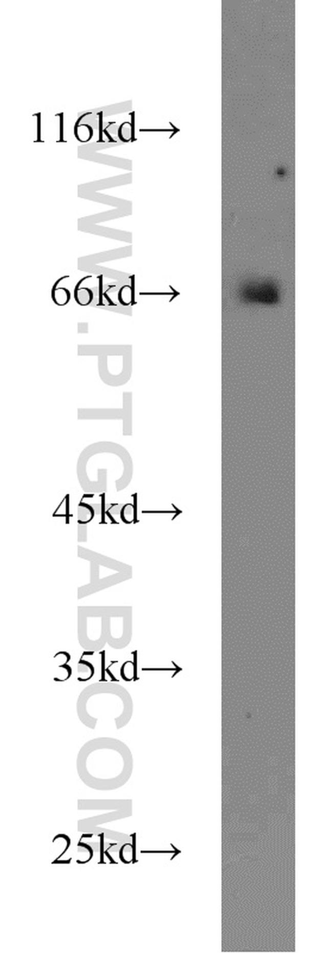 ACBD3 Antibody in Western Blot (WB)