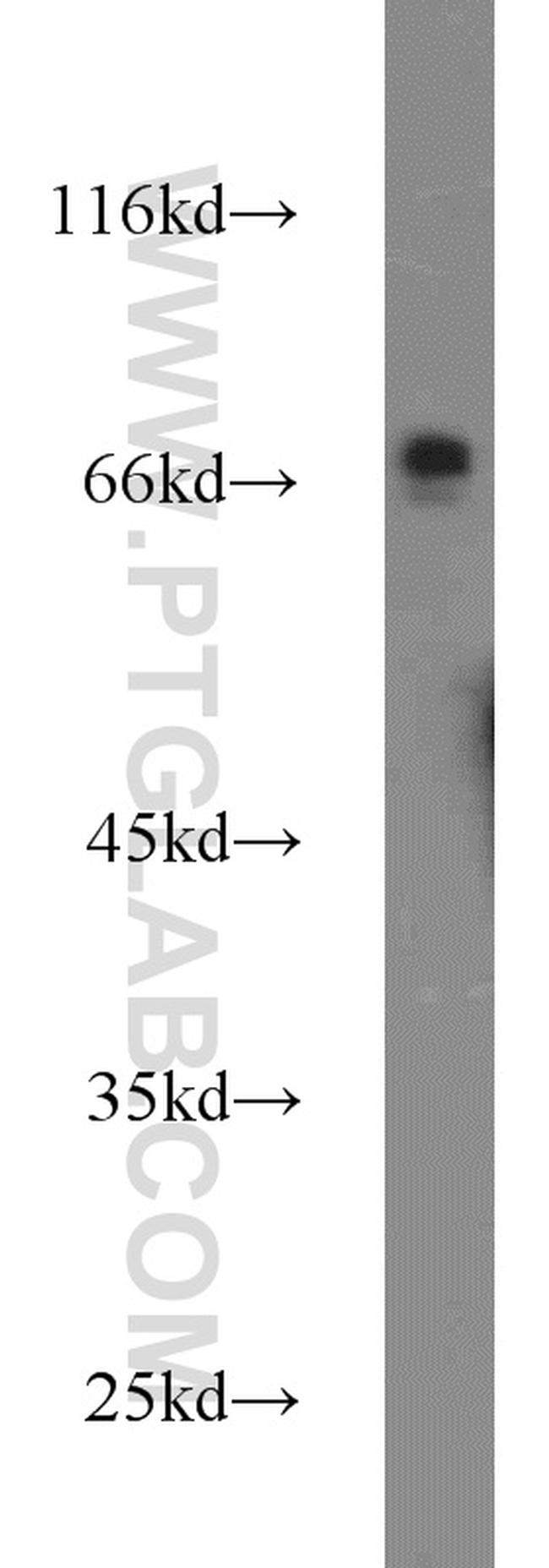 ACBD3 Antibody in Western Blot (WB)