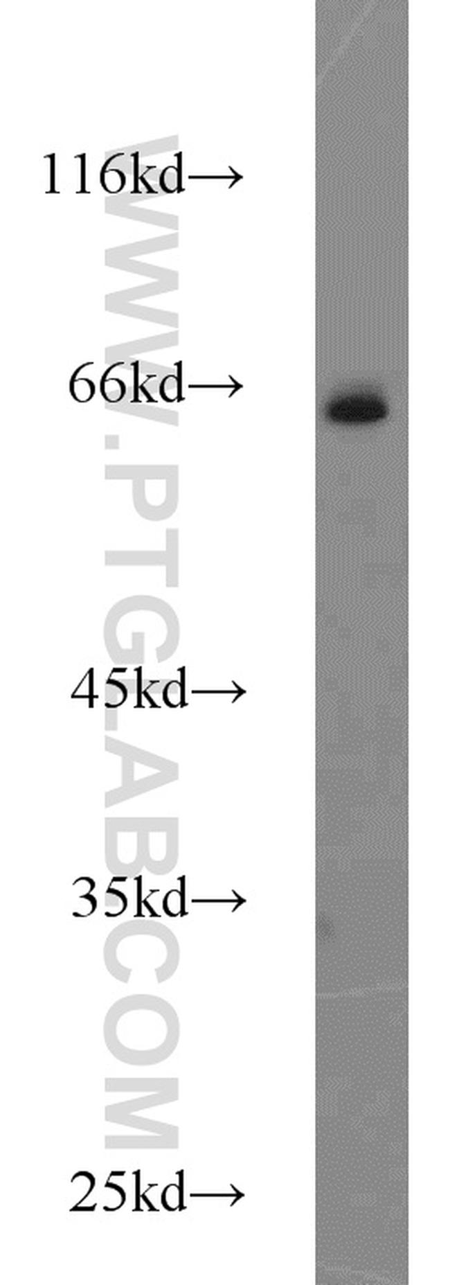 ACBD3 Antibody in Western Blot (WB)