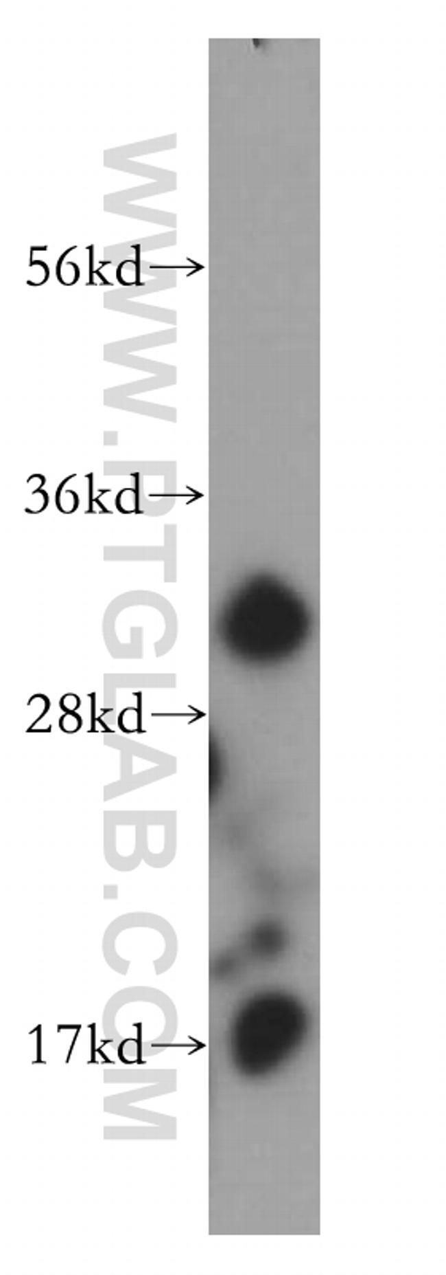 CNOT7 Antibody in Western Blot (WB)