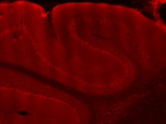 GABRG2 Antibody in Immunohistochemistry (IHC)