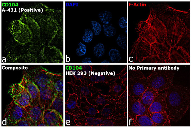 CD104 (Integrin beta 4) Antibody in Immunocytochemistry (ICC/IF)