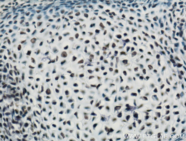 ARNT/HIF1B Antibody in Immunohistochemistry (Paraffin) (IHC (P))