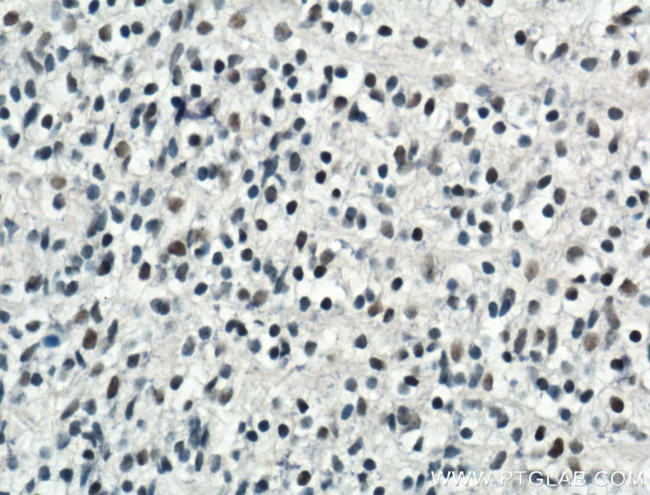 ARNT/HIF1B Antibody in Immunohistochemistry (Paraffin) (IHC (P))