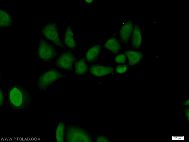 RNF8 Antibody in Immunocytochemistry (ICC/IF)