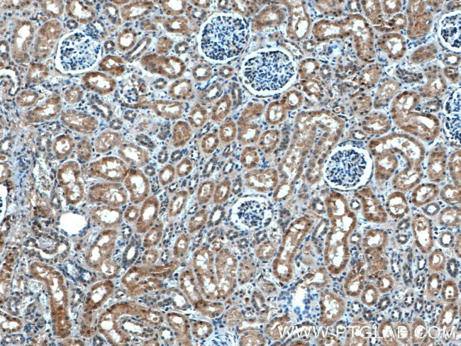 ASPH Antibody in Immunohistochemistry (Paraffin) (IHC (P))