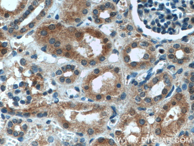 ASPH Antibody in Immunohistochemistry (Paraffin) (IHC (P))