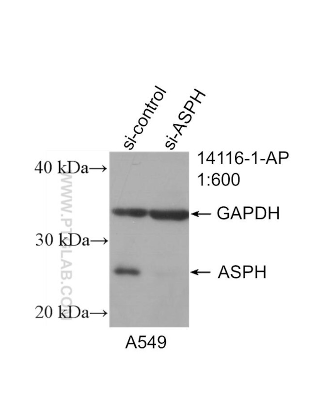 ASPH Antibody in Western Blot (WB)