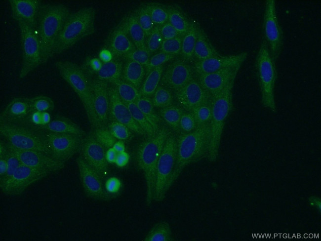 FADS Antibody in Immunocytochemistry (ICC/IF)