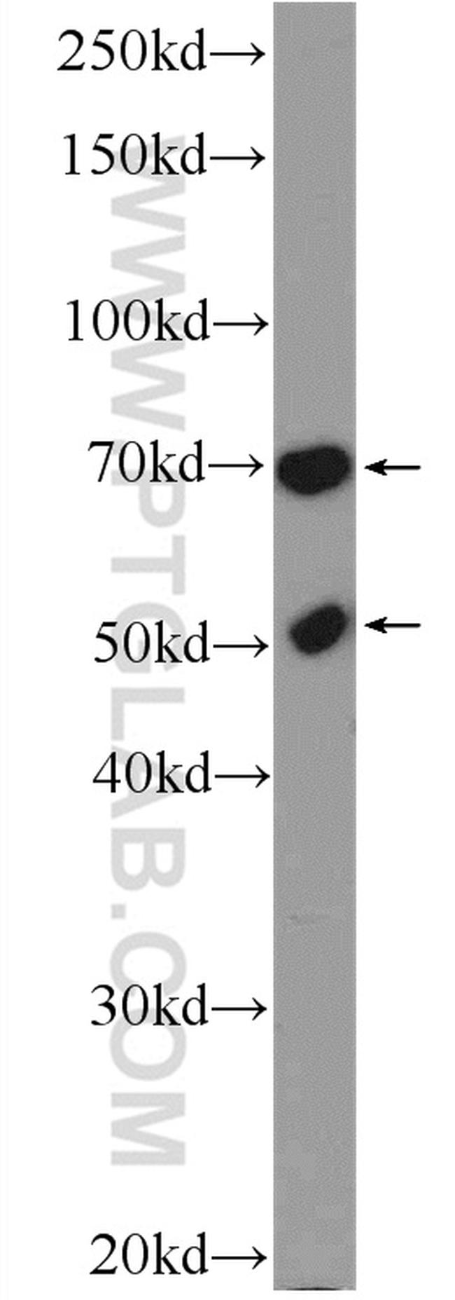 FADS Antibody in Western Blot (WB)