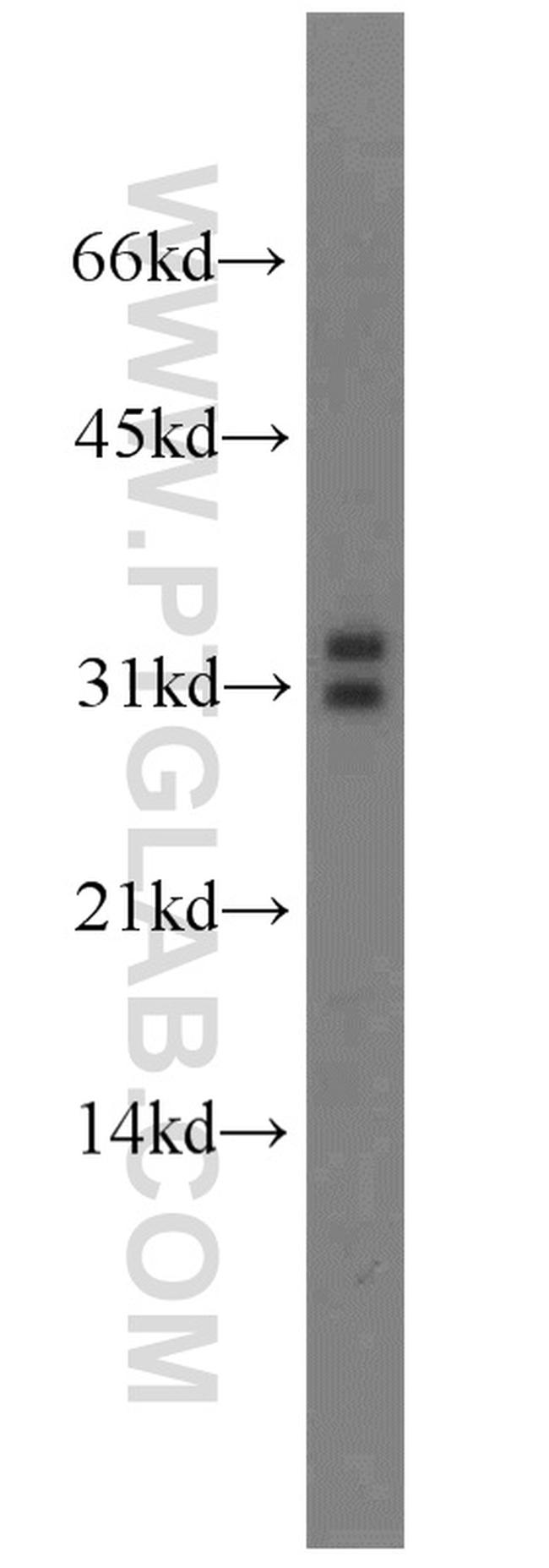 MARCH8 Antibody in Western Blot (WB)