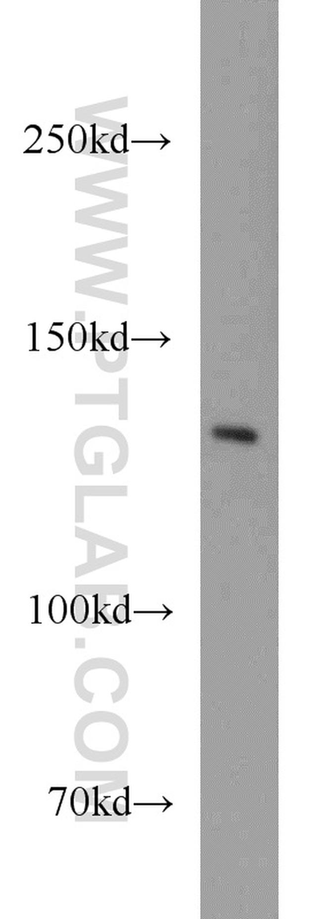 TPPII Antibody in Western Blot (WB)