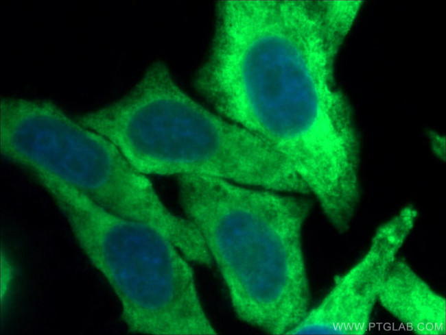 RPS3A Antibody in Immunocytochemistry (ICC/IF)