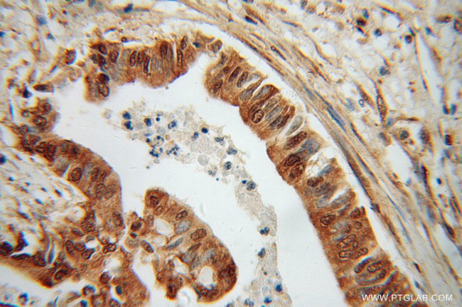 RPS3A Antibody in Immunohistochemistry (Paraffin) (IHC (P))