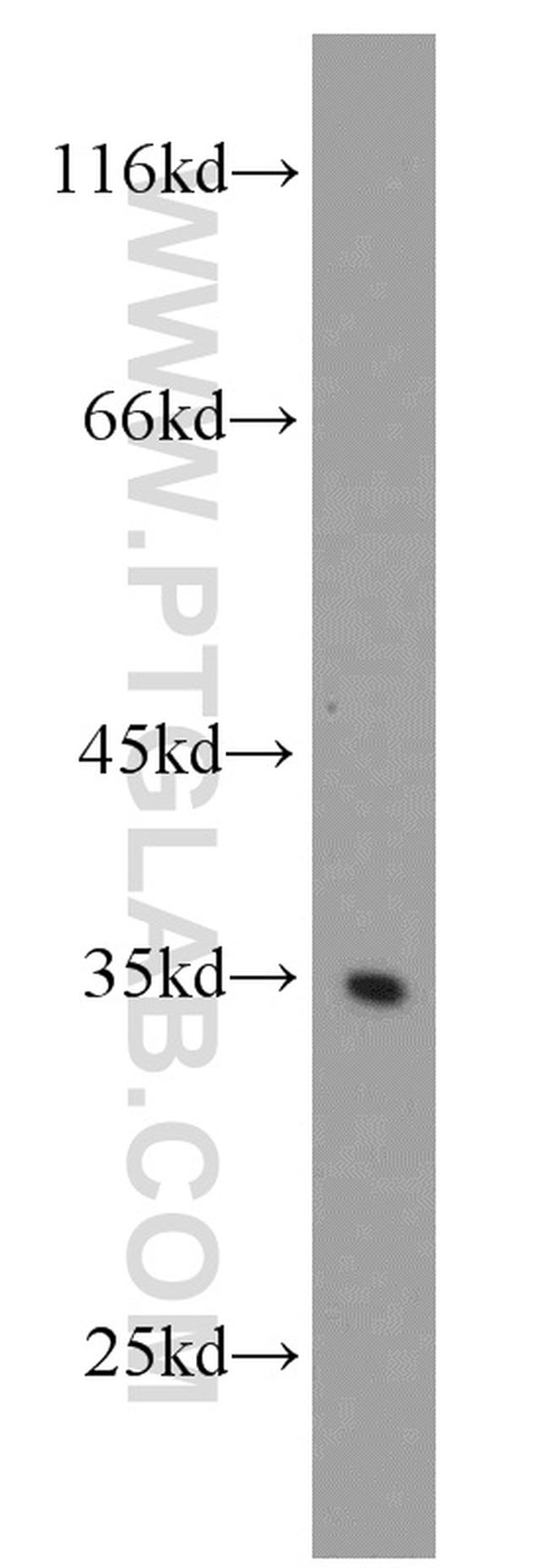 RPS3A Antibody in Western Blot (WB)