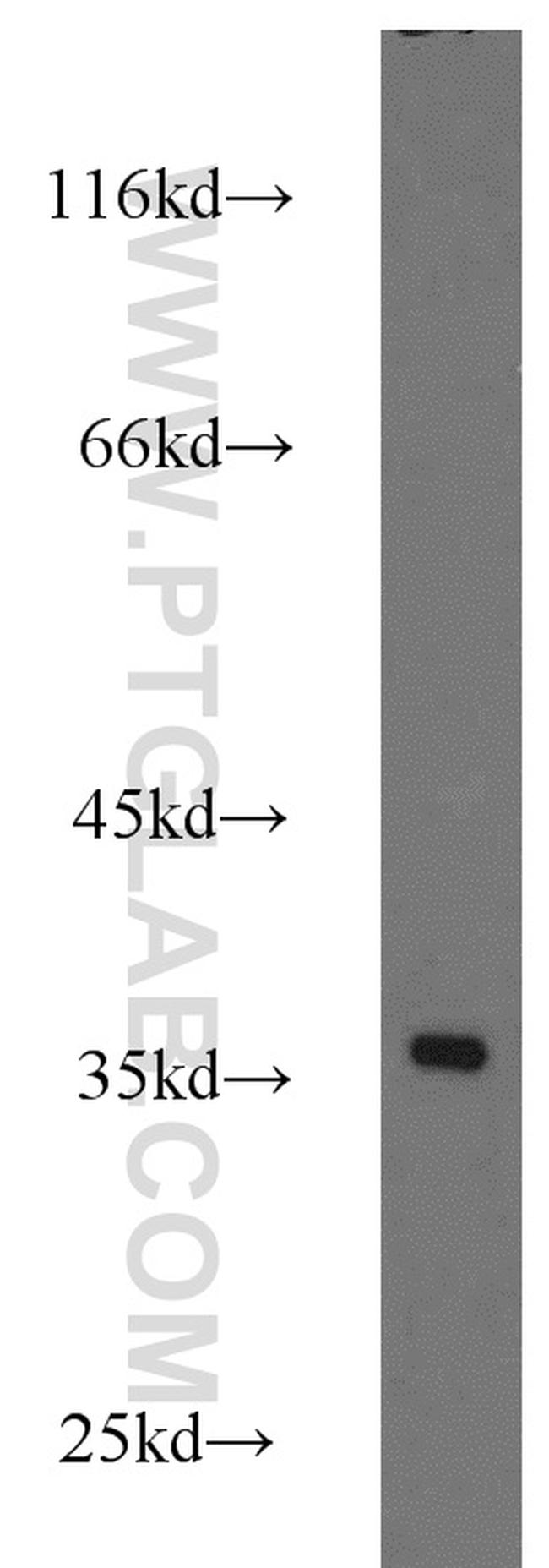 RPS3A Antibody in Western Blot (WB)