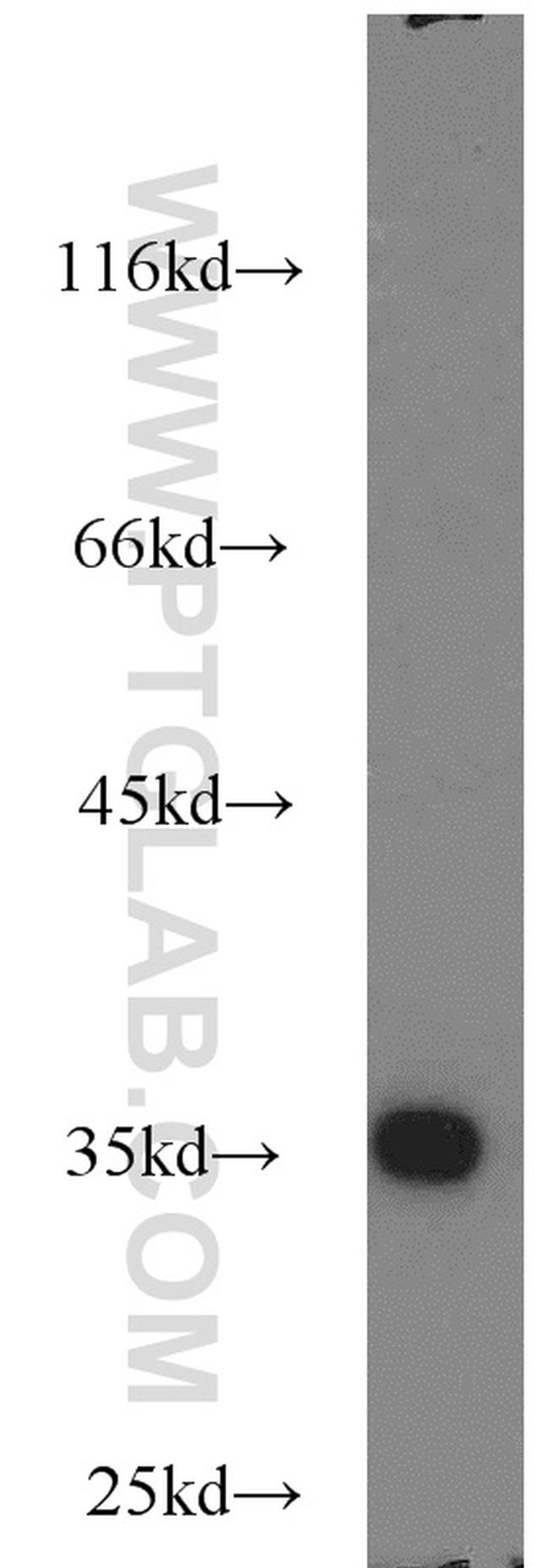 RPS3A Antibody in Western Blot (WB)