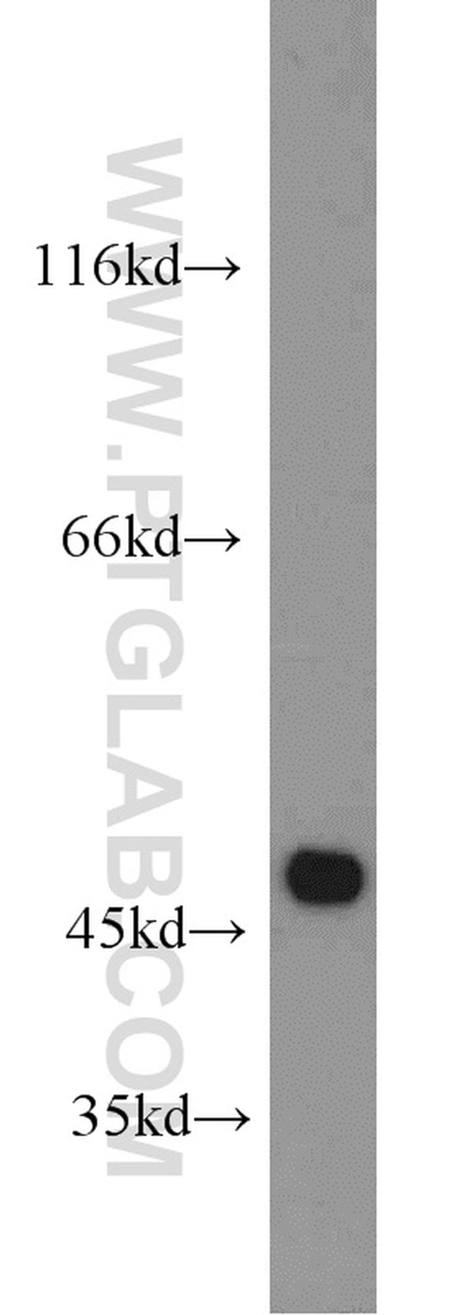 MARCKSL1 Antibody in Western Blot (WB)