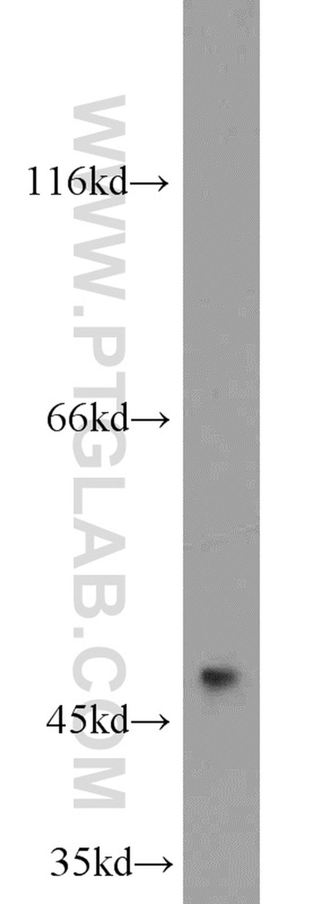 MARCKSL1 Antibody in Western Blot (WB)