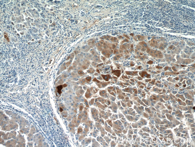 GFPT1 Antibody in Immunohistochemistry (Paraffin) (IHC (P))