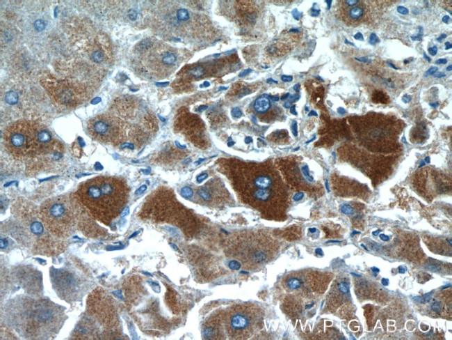 GFPT1 Antibody in Immunohistochemistry (Paraffin) (IHC (P))