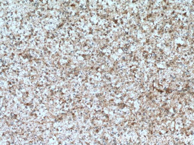 GFPT1 Antibody in Immunohistochemistry (Paraffin) (IHC (P))