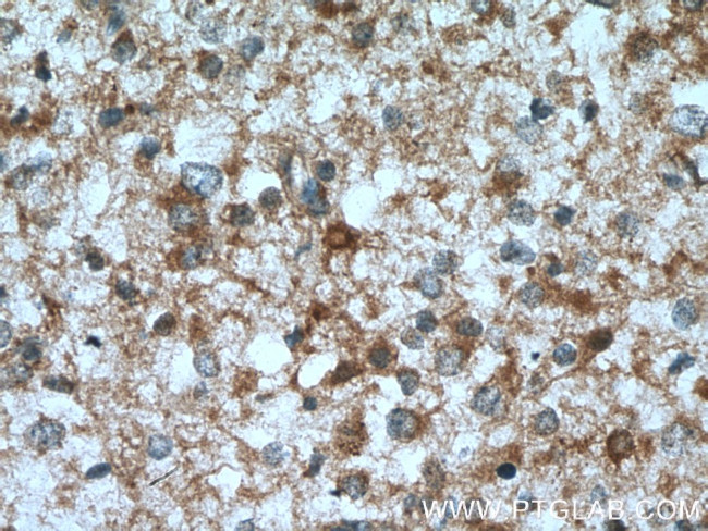 GFPT1 Antibody in Immunohistochemistry (Paraffin) (IHC (P))