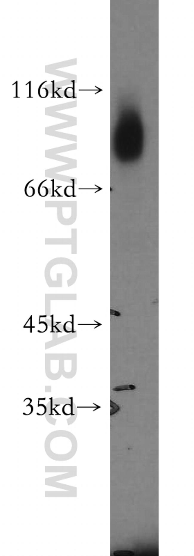 GFPT1 Antibody in Western Blot (WB)