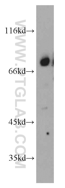beta-ENaC Antibody in Western Blot (WB)
