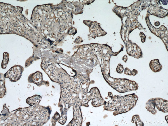 ADAM12 Antibody in Immunohistochemistry (Paraffin) (IHC (P))