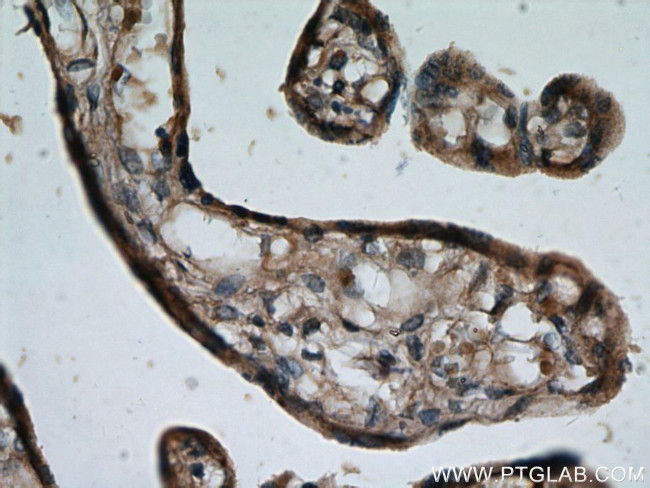 ADAM12 Antibody in Immunohistochemistry (Paraffin) (IHC (P))