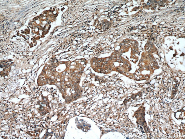 ADAM12 Antibody in Immunohistochemistry (Paraffin) (IHC (P))