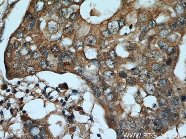 ADAM12 Antibody in Immunohistochemistry (Paraffin) (IHC (P))