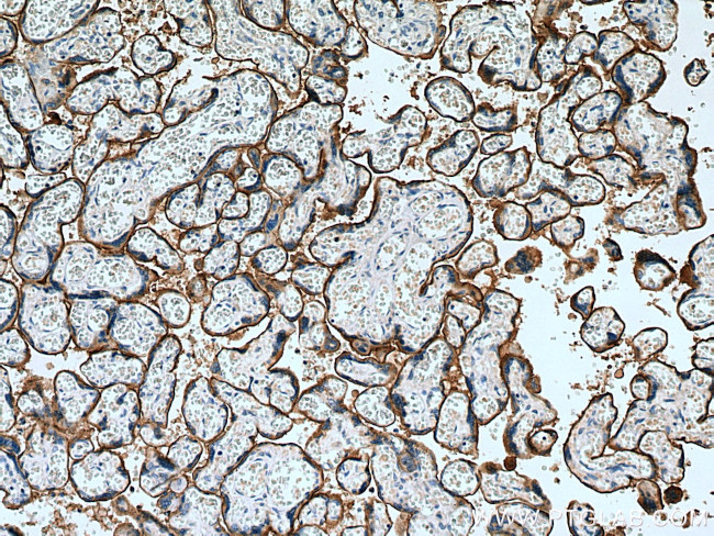 ADAM12 Antibody in Immunohistochemistry (Paraffin) (IHC (P))