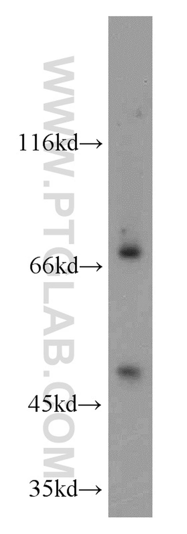 ADAM12 Antibody in Western Blot (WB)