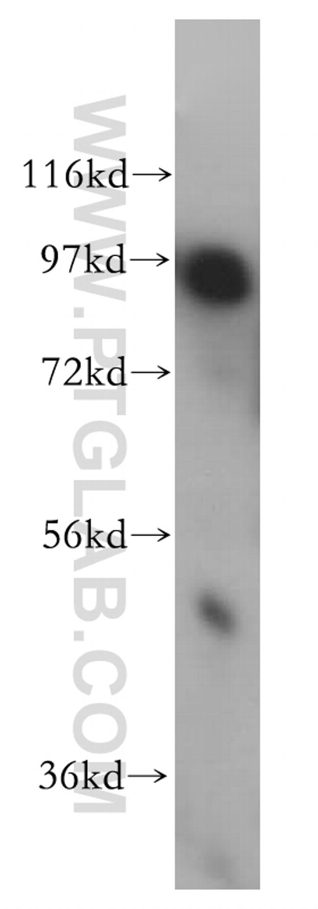 ADAM12 Antibody in Western Blot (WB)