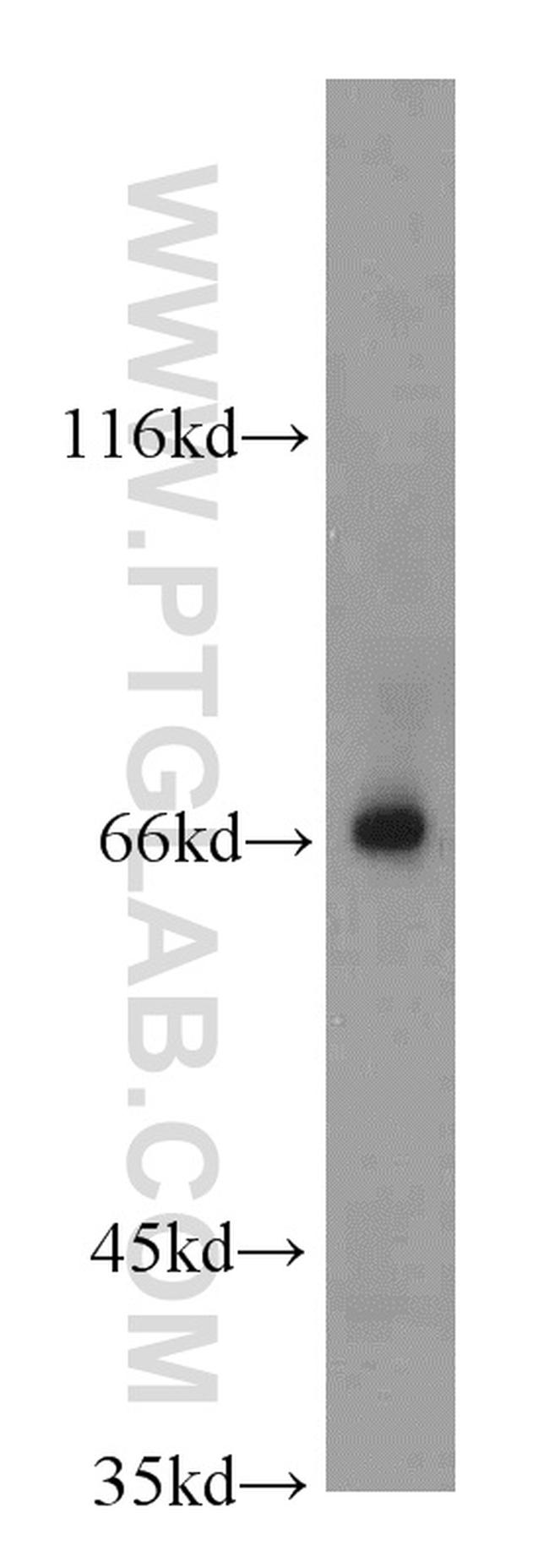 ADAM12 Antibody in Western Blot (WB)