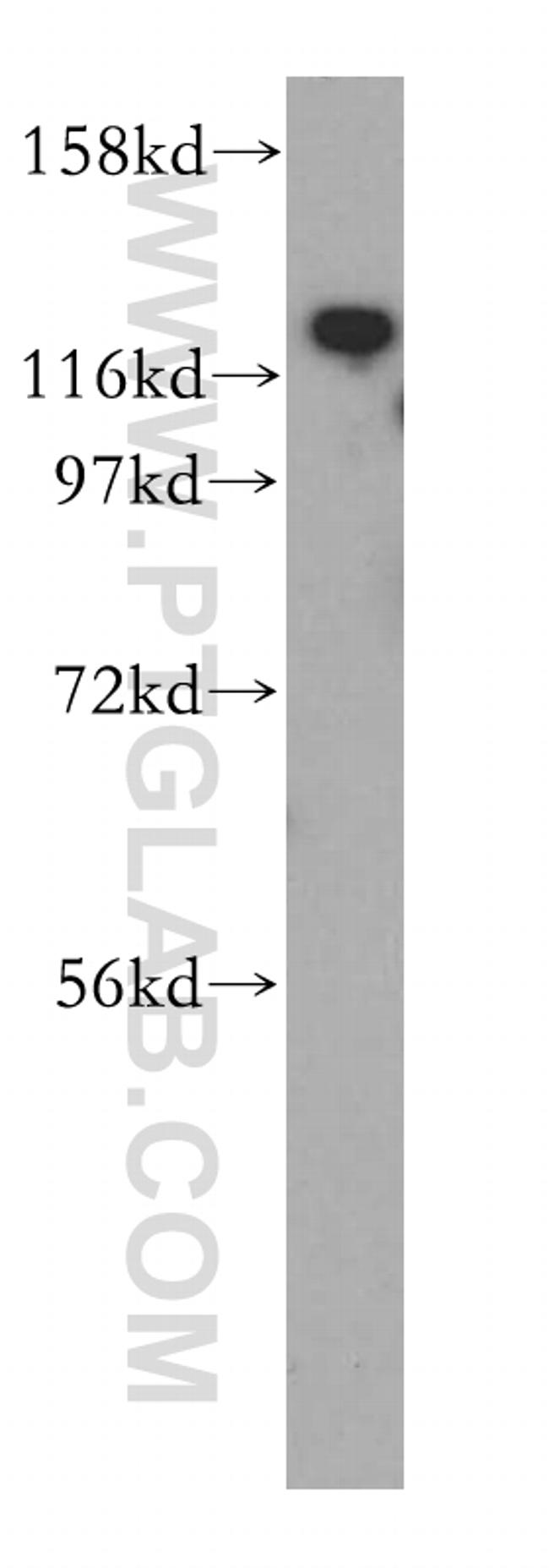 ADAM12 Antibody in Western Blot (WB)