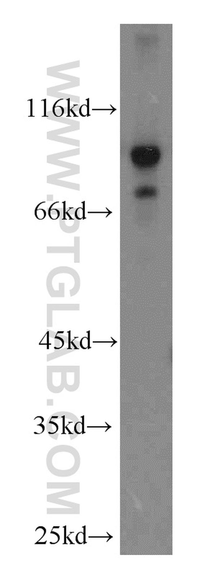 ADAM12 Antibody in Western Blot (WB)