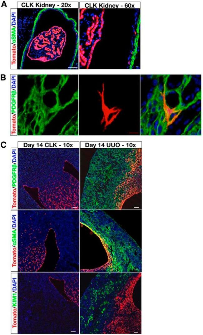 CD140b (PDGFRB) Antibody in Immunohistochemistry (IHC)