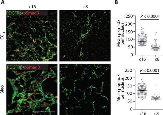 CD140b (PDGFRB) Antibody in Immunohistochemistry (IHC)