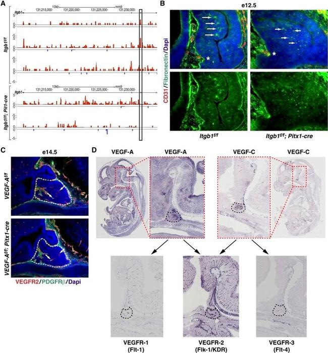 CD140b (PDGFRB) Antibody in Immunohistochemistry (IHC)