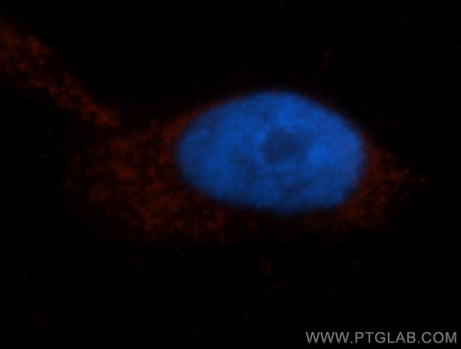 ISYNA1 Antibody in Immunocytochemistry (ICC/IF)