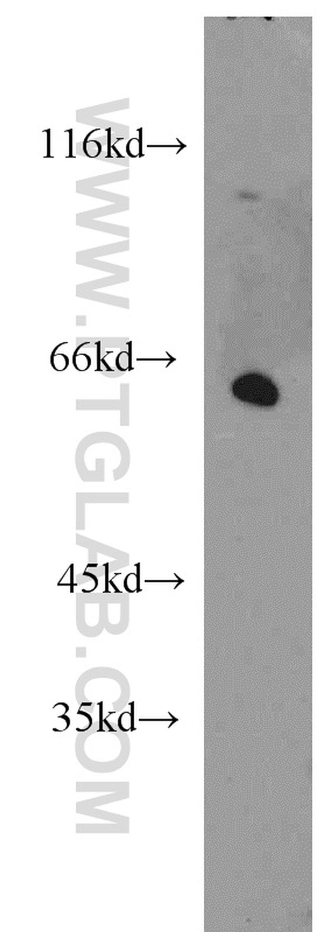 ISYNA1 Antibody in Western Blot (WB)